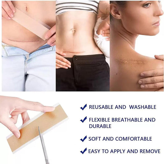 Silicone Scar Tape,Silicone Scar Sheets,Scar Tape for Surgical Scars,Silicone Scar Removal Strips for Surgical,C-Section,Tummy Tuck,Keloid Scars(1.6"X 60" Roll-1.5M) Keloid Bump Removal