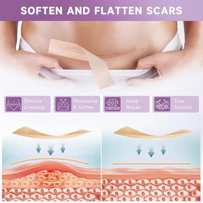 Silicone Scar Tape,Silicone Scar Sheets,Scar Tape for Surgical Scars,Silicone Scar Removal Strips for Surgical,C-Section,Tummy Tuck,Keloid Scars(1.6"X 60" Roll-1.5M) Keloid Bump Removal