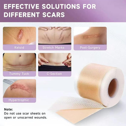 Silicone Scar Tape,Silicone Scar Sheets,Scar Tape for Surgical Scars,Silicone Scar Removal Strips for Surgical,C-Section,Tummy Tuck,Keloid Scars(1.6"X 60" Roll-1.5M) Keloid Bump Removal